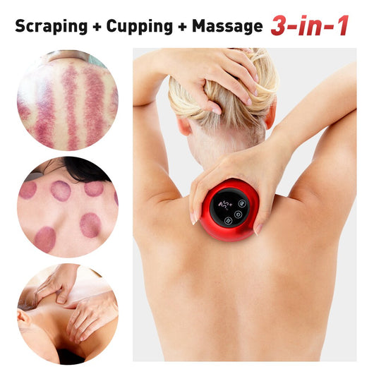 ELECTRIC CUPPING MASSAGER VACUUM SUCTION CUPS RED LIGHT ANTI CELLULITE - TECHIVE